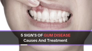 Acme Dental Gum Disease causes and treatment
