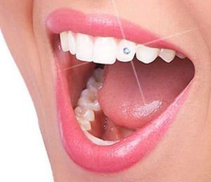 Acme Dental dental jwellary