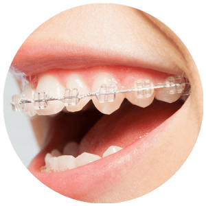 Acme Dental Treatment Of Gum disease