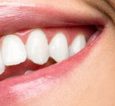 Bruxism of teeth